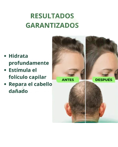 SUPER OFERTA | OUHOE NATURAL SPRAY CRECIMIENTO ACELERADO DEL CABELLO EN SOLO 14 DIAS
