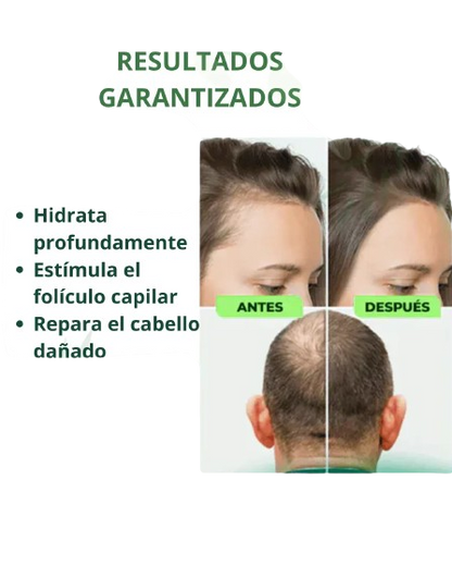 SUPER OFERTA | OUHOE NATURAL SPRAY CRECIMIENTO ACELERADO DEL CABELLO EN SOLO 14 DIAS
